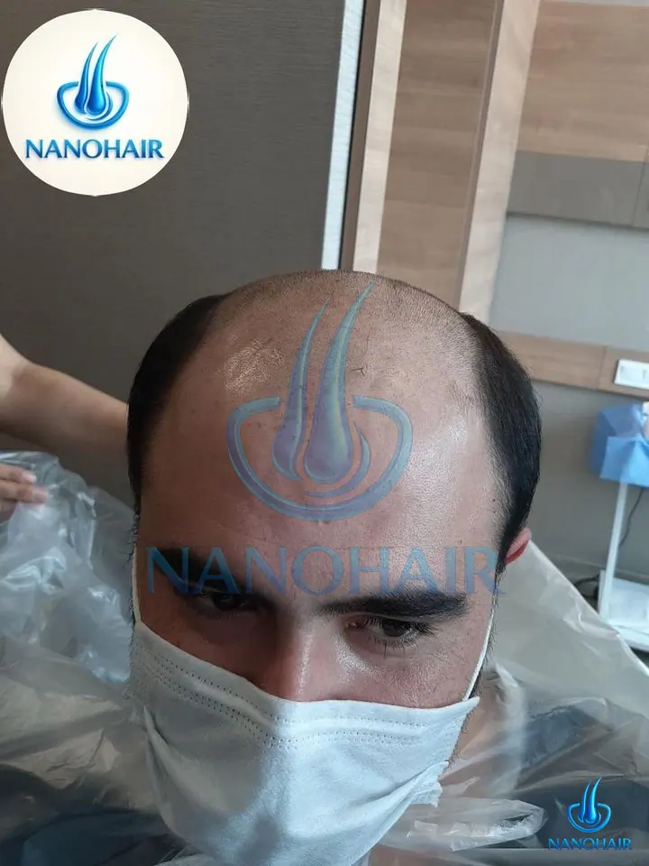 Y*** B. öncesi
