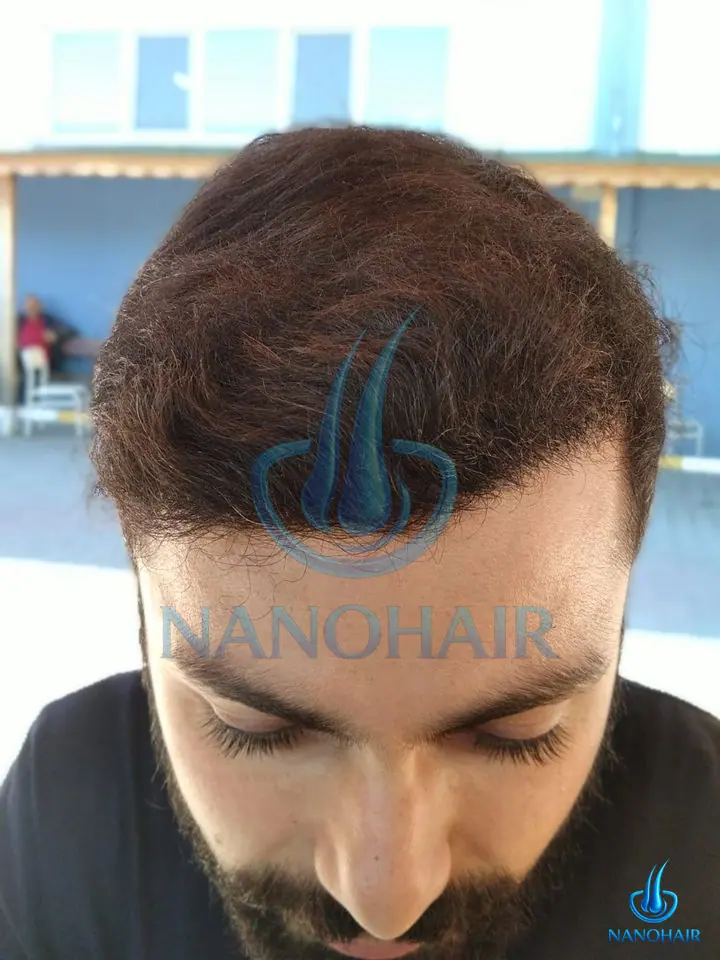 M*** Ç. sonrası