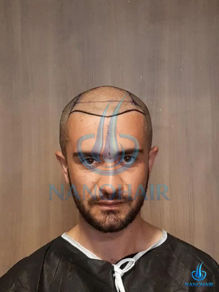 T*** K. öncesi