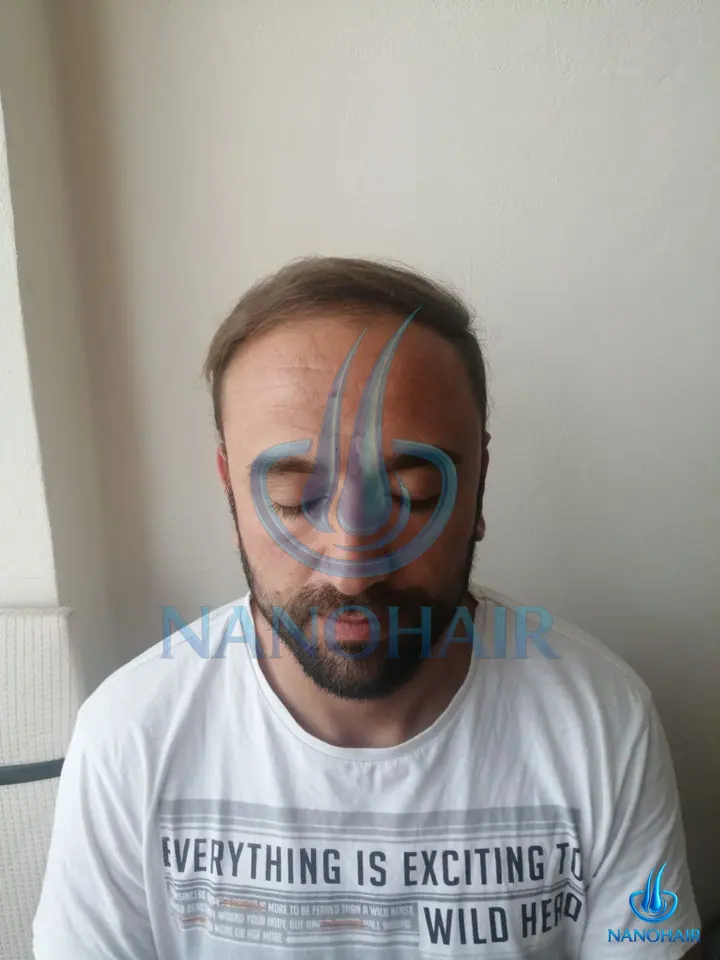 S*** Ö. öncesi