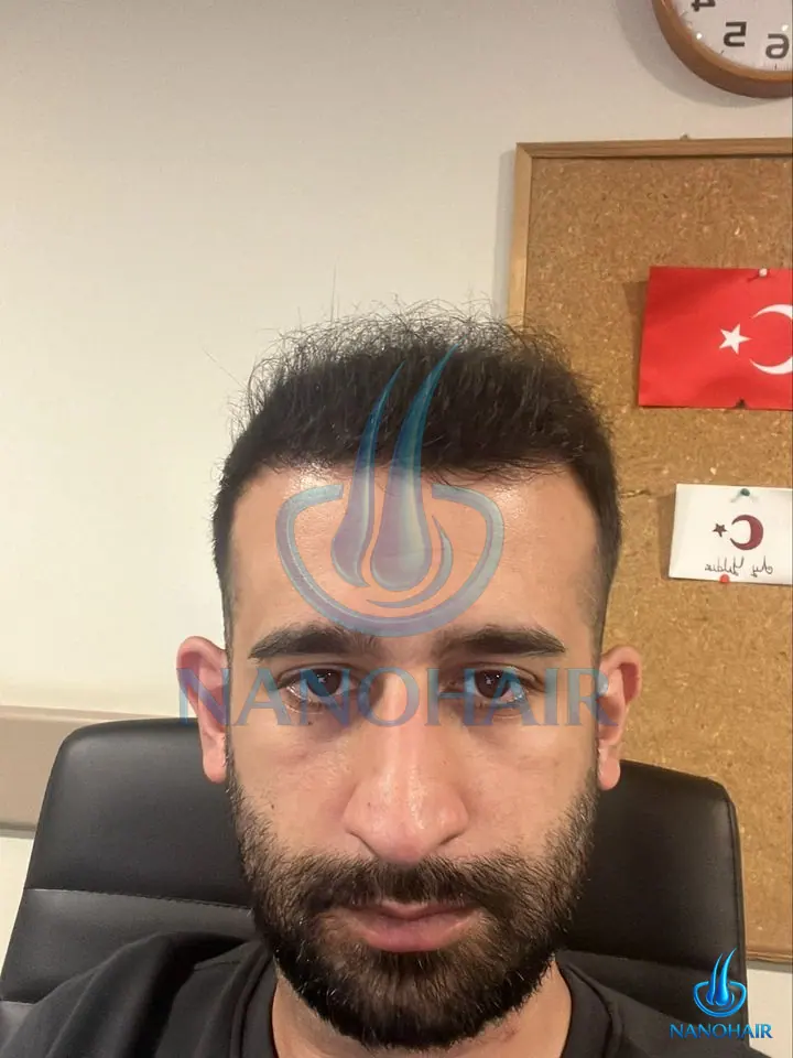 V*** U. sonrası
